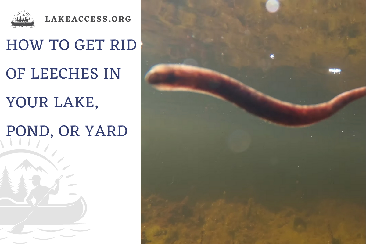 How to Get Rid of Leeches in Your Lake or Pond