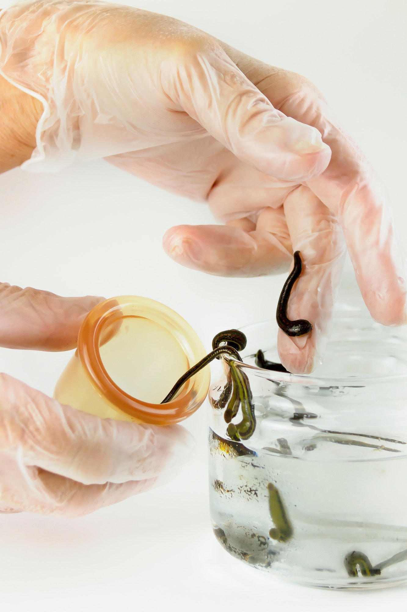 the hand in a medical glove pulls a leech out of a jar of water for placing on the patient